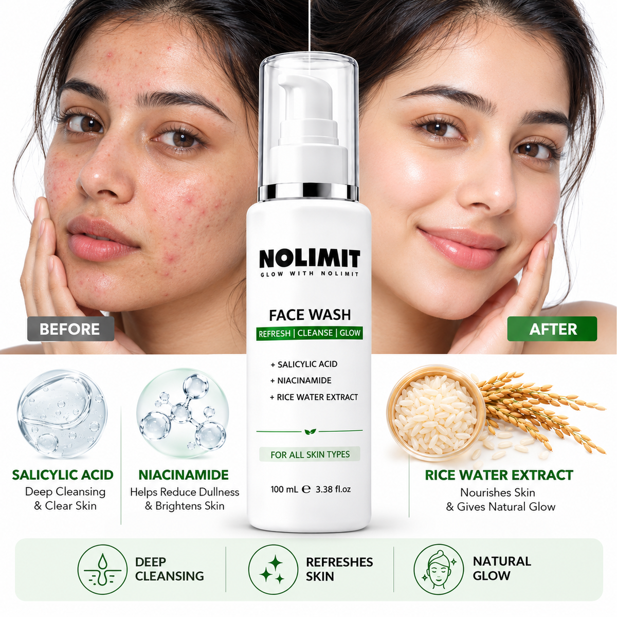 NOLIMIT Face Wash with Salicylic Acid, Niacinamide & Rice Water Extract – 100ml